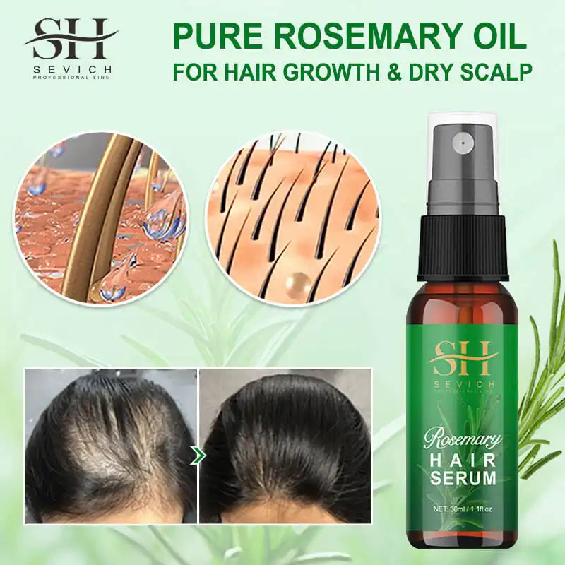 Rosemary Serum for Hair Growth Stop Hair Loss Fast Growing Hair Essential Spray Beauty Hair Care Dry Hair Scalp Refreshing Spray